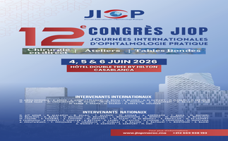 Actualité JIOP